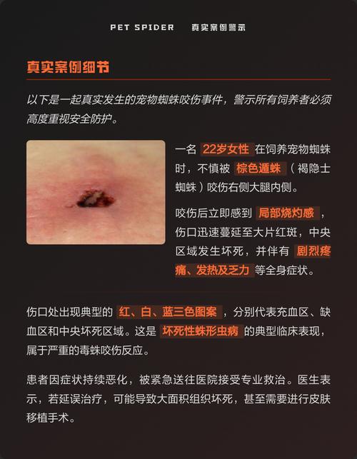 蜘蛛池的风险的相关介绍